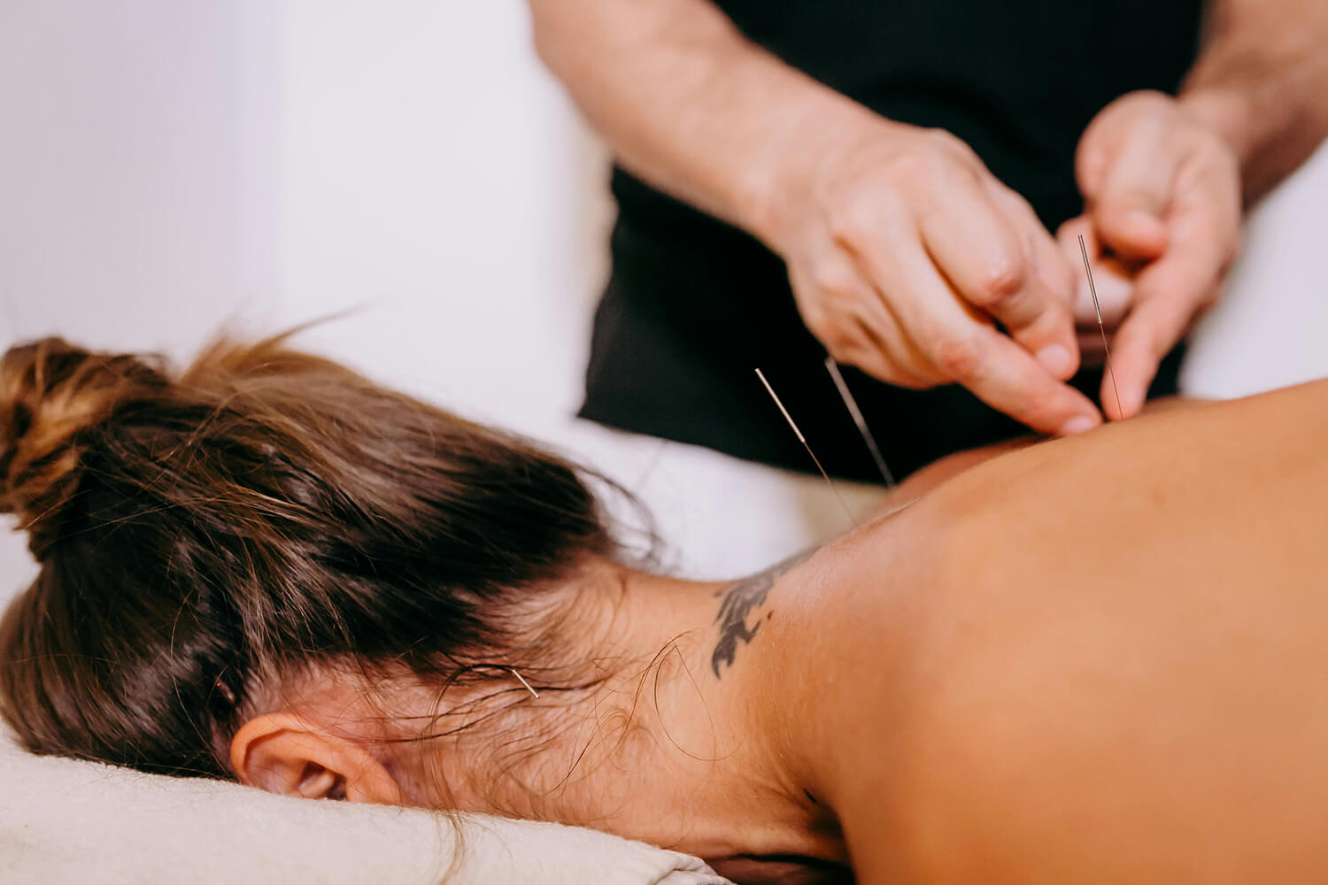 Woman getting acupuncture at Luna Body and Mind in Santa Monica, best acupuncturist in West LA