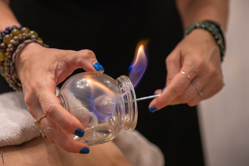 Fire cupping at Luna Body and Mind in Santa Monica, performed by Lola Fox-Rabinovich, top-rated acupuncturist