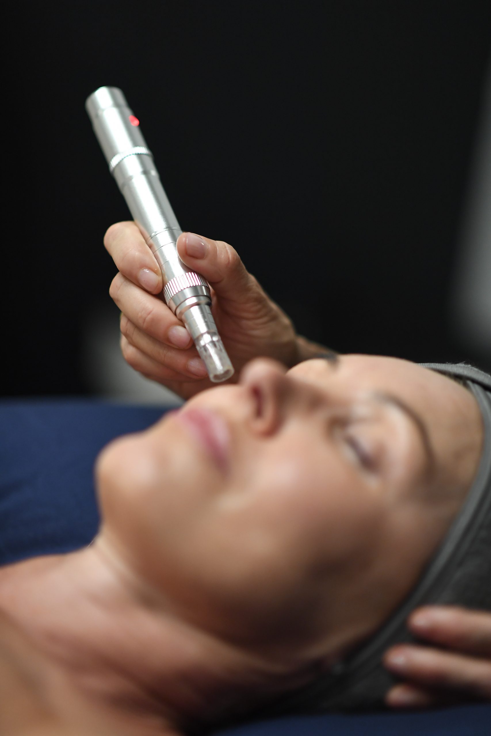 Lola Fox-Rabinovich, a licensed acupuncturist, microneedling patient's face in Santa Monica