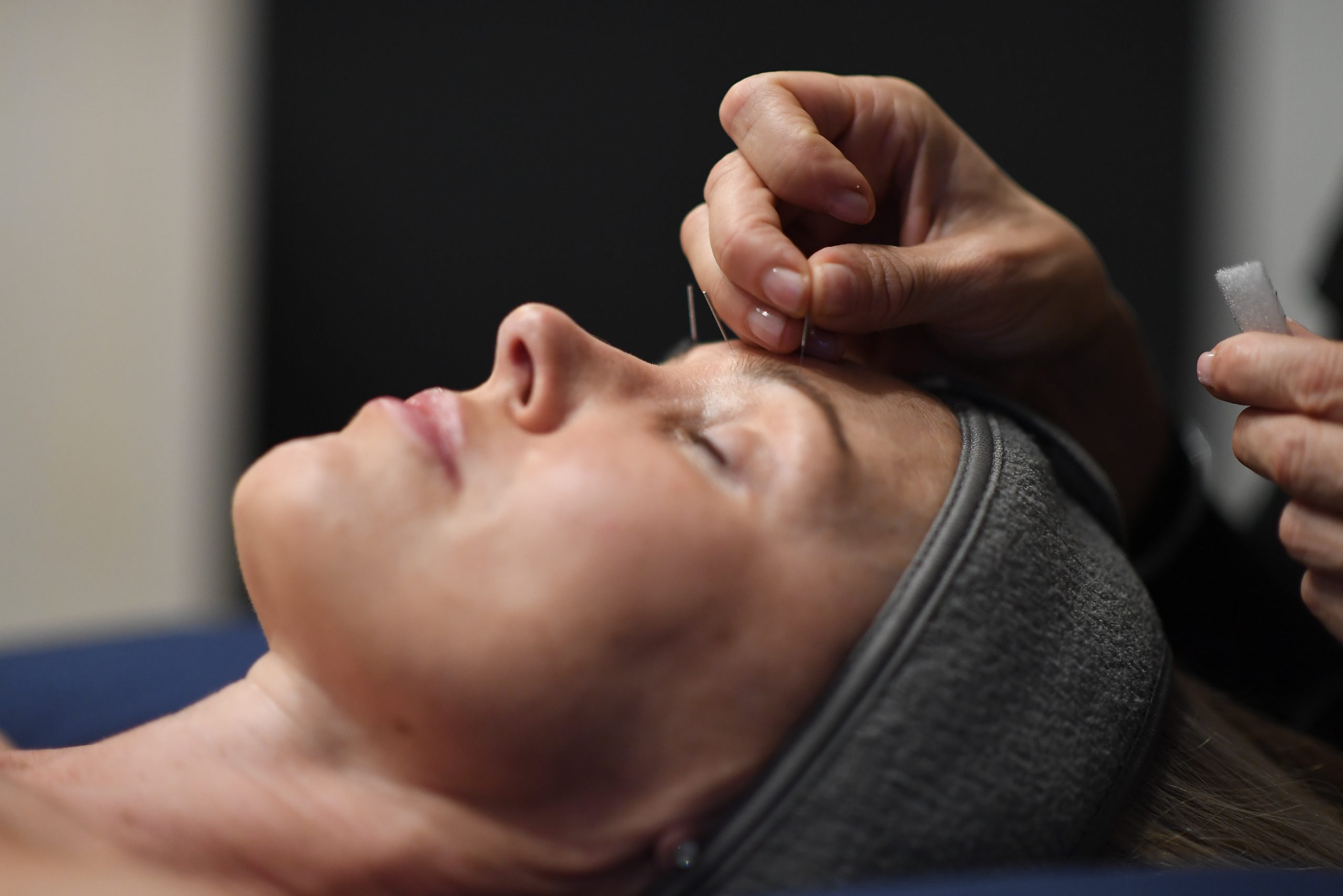 Lola Fox-Rabinovich, a licensed acupuncturist, inserting needles into patient in Santa Monica