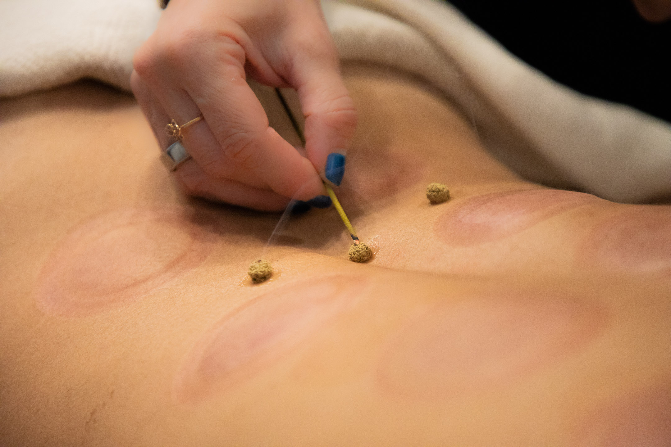 Moxibustion Luna Body and Mind